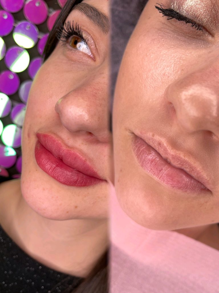 cameraRollTempImage 768x1027